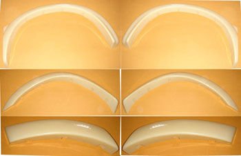 FORD RANGER- PICK UP- 03/07; ÇAMURLUK AGZI PLASTIGI VE TAMPON DODIK SETI (6 PARÇA) (FPI)